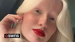 Albino woman has embraced her pale skin and says kids now often mistake her for Elsa from Frozen