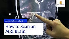 How to Scan an MRI Brain
