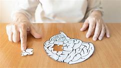 Los hispanos tienen un riesgo "desproporcionadamente mayor" de padecer alzhéimer, revela estudio