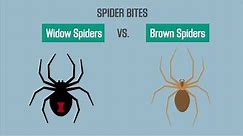 Spider Bites: Black Widow vs. Brown Recluse