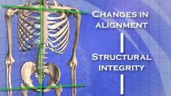 Chiropractor Goldsboro NC | Atlas Orthogonal Chiropractic Specialty at Chiropractic First