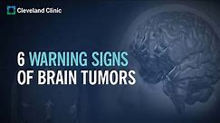 6 Warning Signs of Brain Tumors