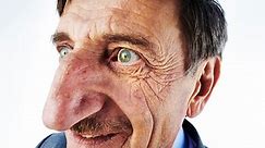 Longest Nose - Guinness World Records
