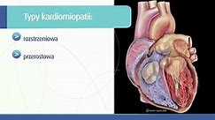 Czym są kardiomiopatie?