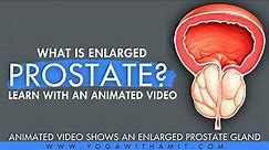 What is an Enlarged Prostate?