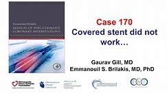 Case 170: Manual of PCI - Covered stent did not work
