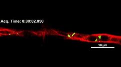 Video S8 Time-lapse imaging of FgVps35-GFP-labelled vesicles and microtubules.