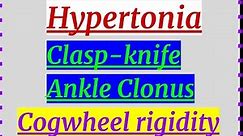 Hypertonia (Clasp-knife, Cogwheel rigidity, Ankle Clonus, Lead pipe rigidity)