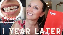 BYTE ALIGNERS REVIEW | 1 year update + byte and pregnancy