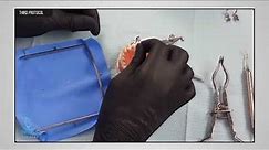 Rubber Dam Placement protocols For Posterior teeth || Multiple Isolation Course part 6