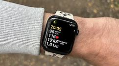 The Apple Watch could get two amazing health features next year