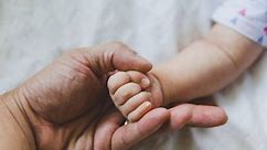 Encefalocele: En qué consiste la anomalía del bebé que nació con “tres cabezas” en India