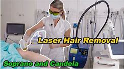 Laser Hair Removal - using Soprano Ice Platinum Laser & Candela Laser -Best Hair Removal in (2021)