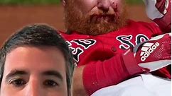 Will MLB have to implement facemasks for hitters someday? #greenscreen #redsox #justinturner