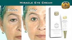 The miracle of Kedma Miracle Eye Cream