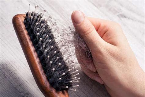 hair loss   common hair diseases