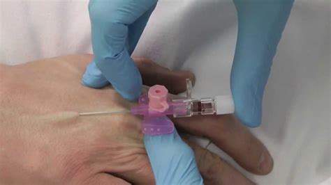 Cannulation How To Insert A Cannula One Minute Edition Medicine In A