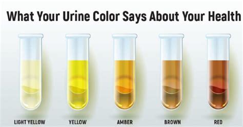 heres   color   urine    body filmymantra