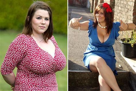 Mum With Giant 38hh Boobs Set For £6k Reduction Op Over Fears Her