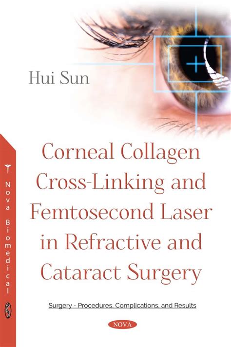 corneal collagen cross linking  femtosecond laser  refractive  cataract surgery nova
