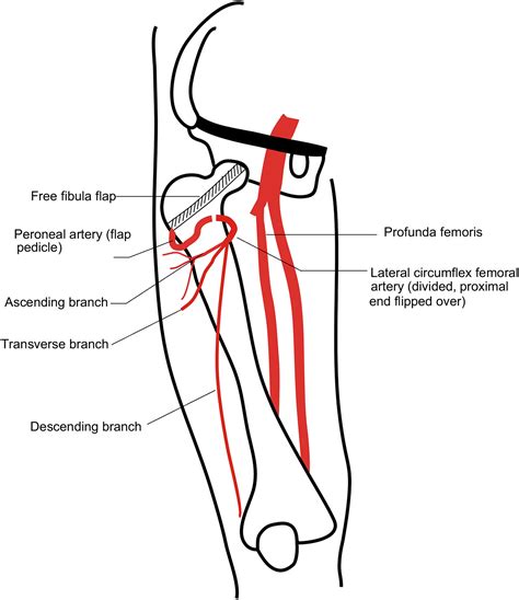 medial circumflex femoral artery branches