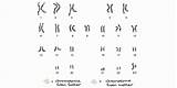 Karyotype Biology Chromosomes Genetic Chessmuseum Genome sketch template