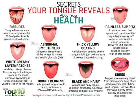 secrets  tongue reveals   health top  home remedies