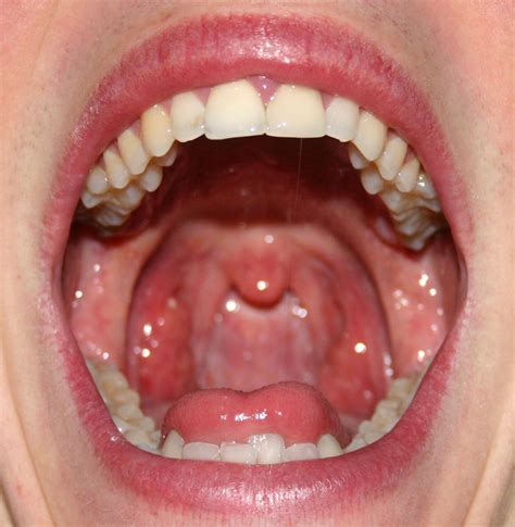 health topics blogs mouth