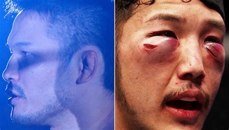 Ufc Fighters Before And After A Fight 15 Pics