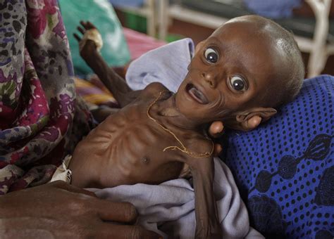 faces  famine photo  pictures cbs news