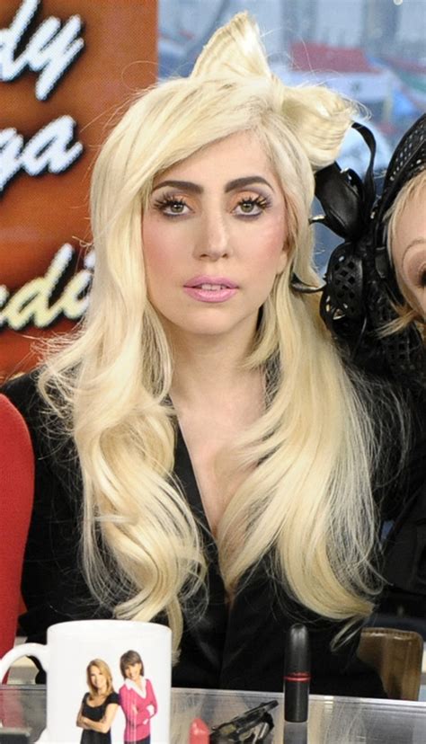 Lady Gaga Face Lift Plastic Surgeon Gives Verdict On