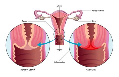 how far is the cervix from the opening mishkanet