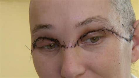 Woman Scalped In Horrific Power Drill Accident Can Smile Again After