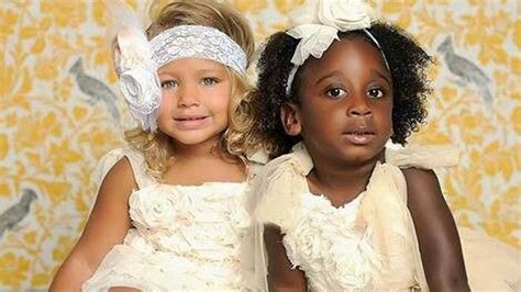 These Twins’ Skin Colors Varied When They Were Born See How They