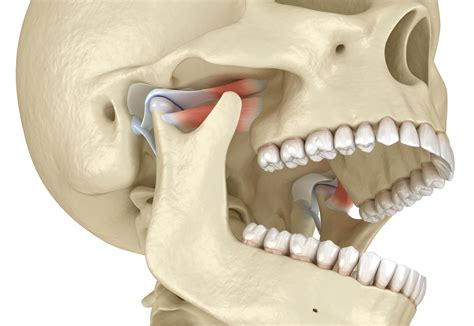 jaw joints dont work properly anymore cedar rapids ia