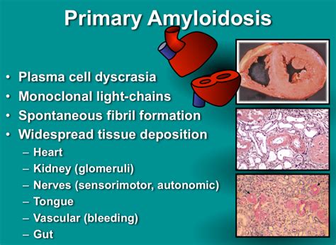amyloidosis strive  good health
