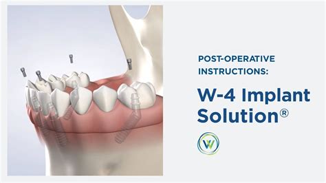 Post Op W 4 Implant Solution® In Arizona Winterholler Dental