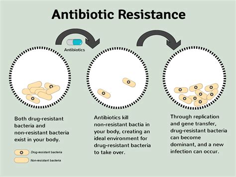 antimicrobial stewardship program important