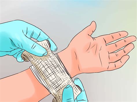 clean  minor wound  steps  pictures wikihow