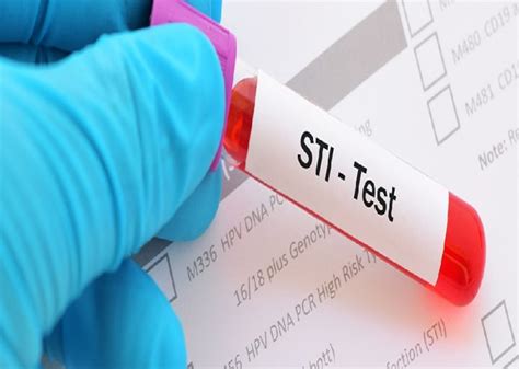 Sexually Transmitted Infections Stis The Standard