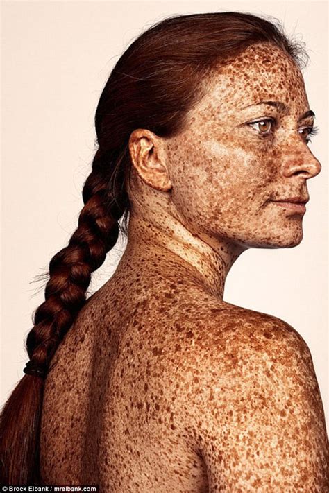 Photographer Brock Elbank Captures Men And Women Covered In Freckles