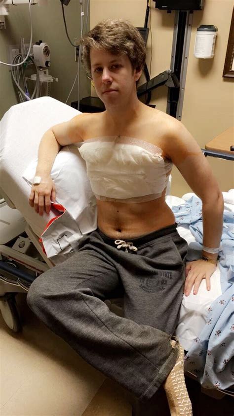 i have so transgendered i had my top surgery today
