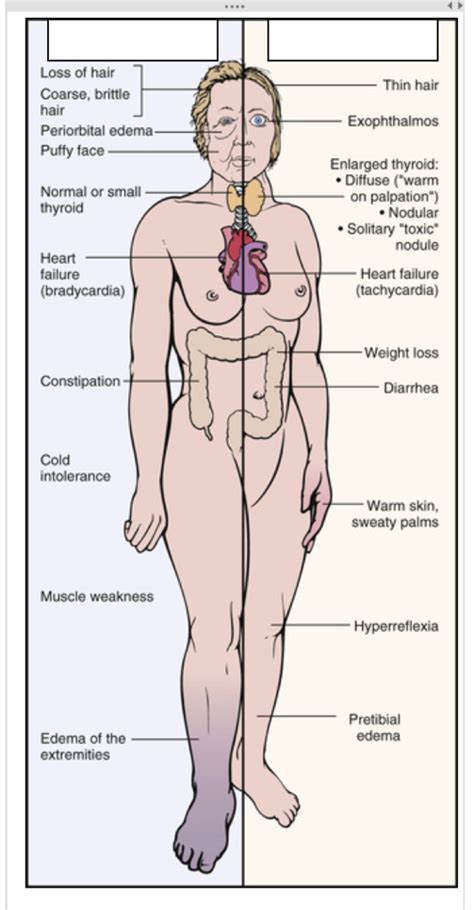 hypothyroidism and hyperthyroidism etiologies cause and clinical