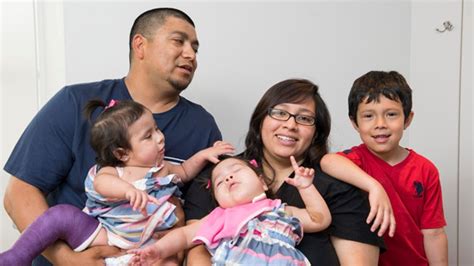 formerly conjoined texas twins reunited at home after long recovery