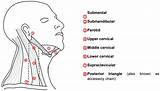 Metastasis Lymph Nodes Cervical Posterior Thyroid Intechopen sketch template