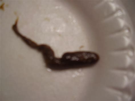warning picture is this a worm parasite at ask curezone