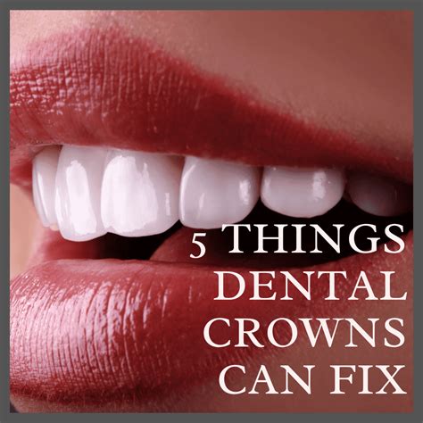 dental crowns  fix glow dental