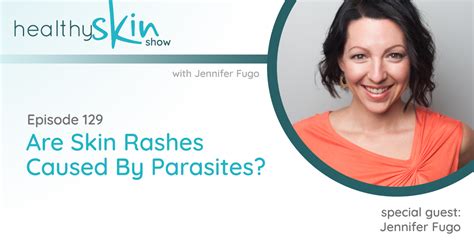 skin rashes caused  parasites