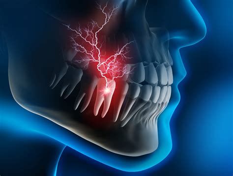 types  tooth pain