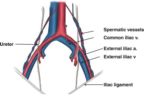 pelvic veins external internal common iliac teach vrogueco